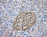 CAPZA1 Antibody in Immunohistochemistry (Paraffin) (IHC (P))