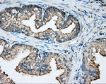 CAPZA1 Antibody in Immunohistochemistry (Paraffin) (IHC (P))