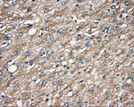 CAPZA1 Antibody in Immunohistochemistry (Paraffin) (IHC (P))