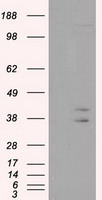 CAPZA1 Antibody in Western Blot (WB)