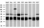 CAPZA1 Antibody in Western Blot (WB)