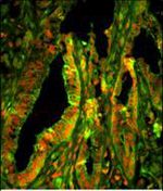 CAPZA1 Antibody in Immunohistochemistry (Paraffin) (IHC (P))