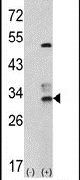CAPZB Antibody in Western Blot (WB)