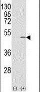 CAPZB Antibody in Western Blot (WB)
