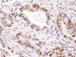 CARM1 Antibody in Immunohistochemistry (IHC)