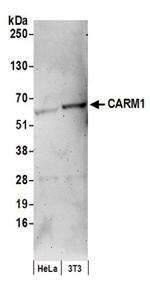 CARM1 Antibody in Western Blot (WB)