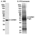 CARM1 Antibody in Western Blot (WB)