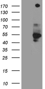 Cas9 Antibody in Western Blot (WB)
