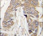 CASC3 Antibody in Immunohistochemistry (IHC)