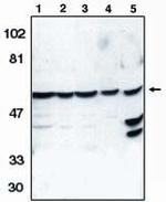 Caspase 10 Antibody in Western Blot (WB)