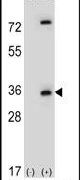 Caspase 3 (Cleaved Asp175) Antibody in Western Blot (WB)