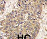 Caspase 6 Antibody in Immunohistochemistry (IHC)