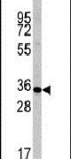 Caspase 6 Antibody in Western Blot (WB)