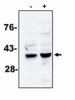 Caspase 7 Monoclonal Antibody (MCH3-5)