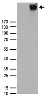 CASR Antibody in Western Blot (WB)