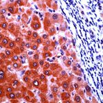 CAS Antibody in Immunohistochemistry (IHC)