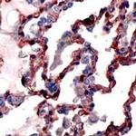 Caveolin 1 Antibody in Immunohistochemistry (IHC)
