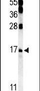 Caveolin 2 Antibody in Western Blot (WB)