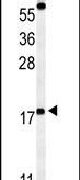 Caveolin 2 Antibody in Western Blot (WB)