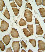 Caveolin 3 Antibody in Immunohistochemistry (IHC)
