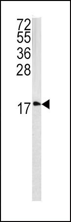 Caveolin 3 Antibody in Western Blot (WB)