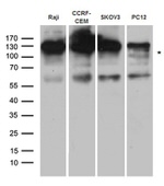 CBL Antibody in Western Blot (WB)