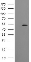 CBLC Antibody in Western Blot (WB)