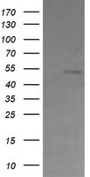 CBLC Antibody in Western Blot (WB)