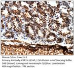 Galectin 3 Antibody in Immunohistochemistry (IHC)
