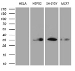 CBR1 Antibody in Western Blot (WB)