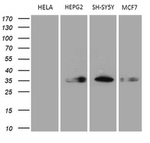 CBR1 Antibody in Western Blot (WB)