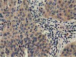 CBWD1 Antibody in Immunohistochemistry (Paraffin) (IHC (P))