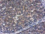 CBWD1 Antibody in Immunohistochemistry (Paraffin) (IHC (P))