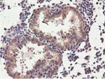 CBWD1 Antibody in Immunohistochemistry (Paraffin) (IHC (P))