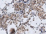 CBWD1 Antibody in Immunohistochemistry (Paraffin) (IHC (P))