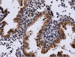 CBWD1 Antibody in Immunohistochemistry (Paraffin) (IHC (P))