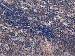 CBWD1 Antibody in Immunohistochemistry (Paraffin) (IHC (P))