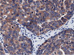 CBWD1 Antibody in Immunohistochemistry (Paraffin) (IHC (P))