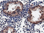 CBWD1 Antibody in Immunohistochemistry (Paraffin) (IHC (P))