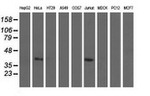 CBWD1 Antibody in Western Blot (WB)