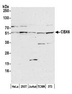 CBX6 Antibody in Western Blot (WB)