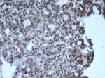 CBX8 Antibody in Immunohistochemistry (Paraffin) (IHC (P))