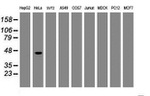 CBX8 Antibody in Western Blot (WB)