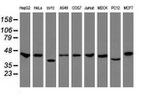 CBX8 Antibody in Western Blot (WB)