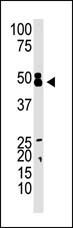 CBX8 Antibody in Western Blot (WB)