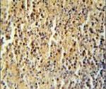 CCDC106 Antibody in Immunohistochemistry (IHC)