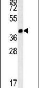 CCDC106 Antibody in Western Blot (WB)