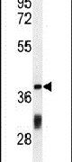 CCDC130 Antibody in Western Blot (WB)