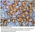 CCAR1 Polyclonal Antibody