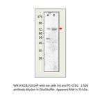 CACNB2 Polyclonal Antibody